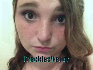 Freckles4ever